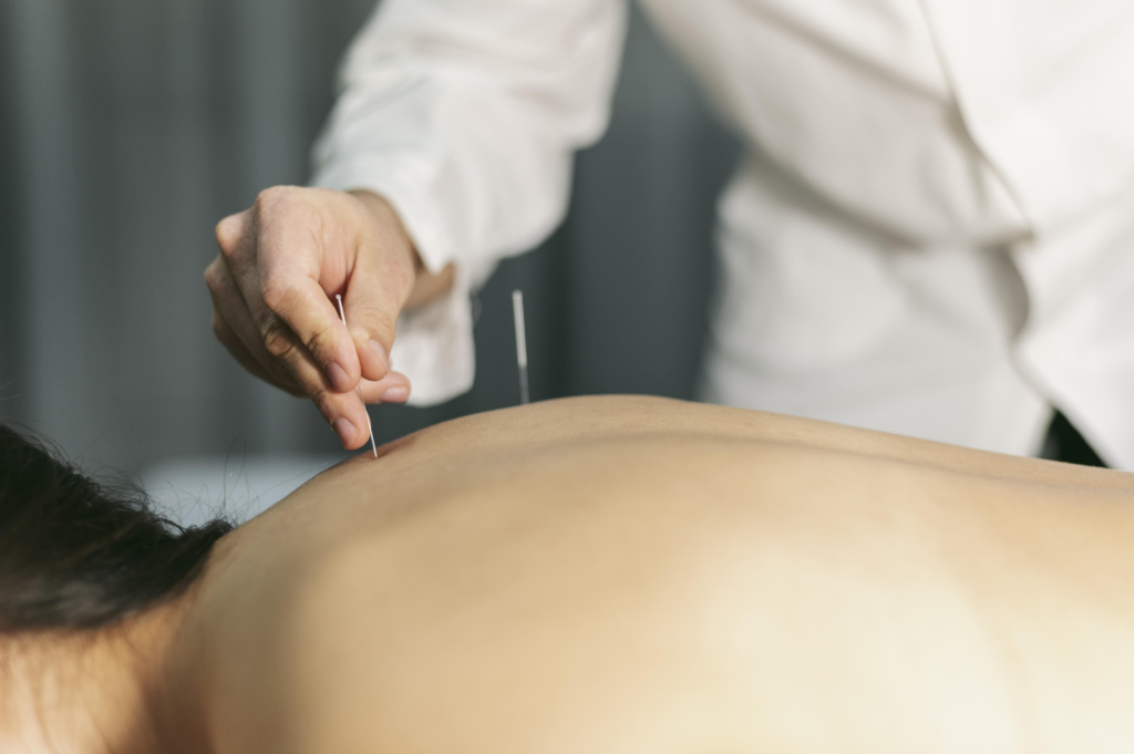 Acupuntura conquista respaldo científico no tratamento da dor